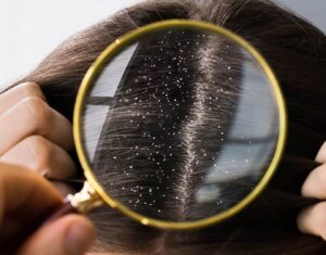 10 χρήσιμα κόλπα με την ασπιρίνη που πρέπει να γνωρίζετε