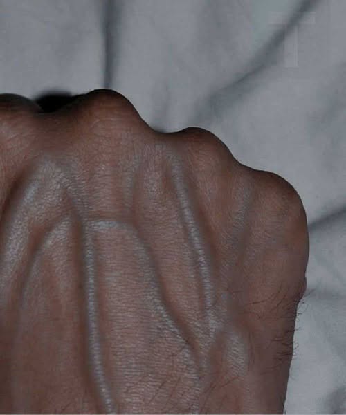5 προβλήματα υγείας που μπορούν να προκαλέσουν ορατές φλέβες