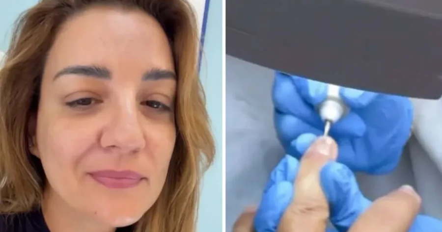 Περιπέτεια υγείας για την Παπίλα: «Όλα ξεκίνησαν όταν άρχισα να βλέπω στα νύχια μου κάτι μικρές γραμμές»
