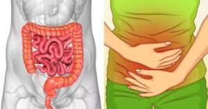 Αέρια στο έντερο: Τι δείχνουν για την υγεία μας – Ποιες οι αιτίες και πως να αντιμετωπίσουμε το πρόβλημα