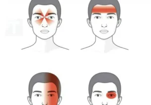 Έτσι αποκαλύπτουν οι πονοκέφαλοι τι δεν πάει καλά με την υγεία σας