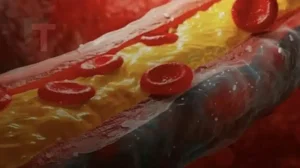 Αυτό είναι το καλύτερο φρούτο για να καθαρίσετε τις αρτηρίες σας και τις φλέβες σας