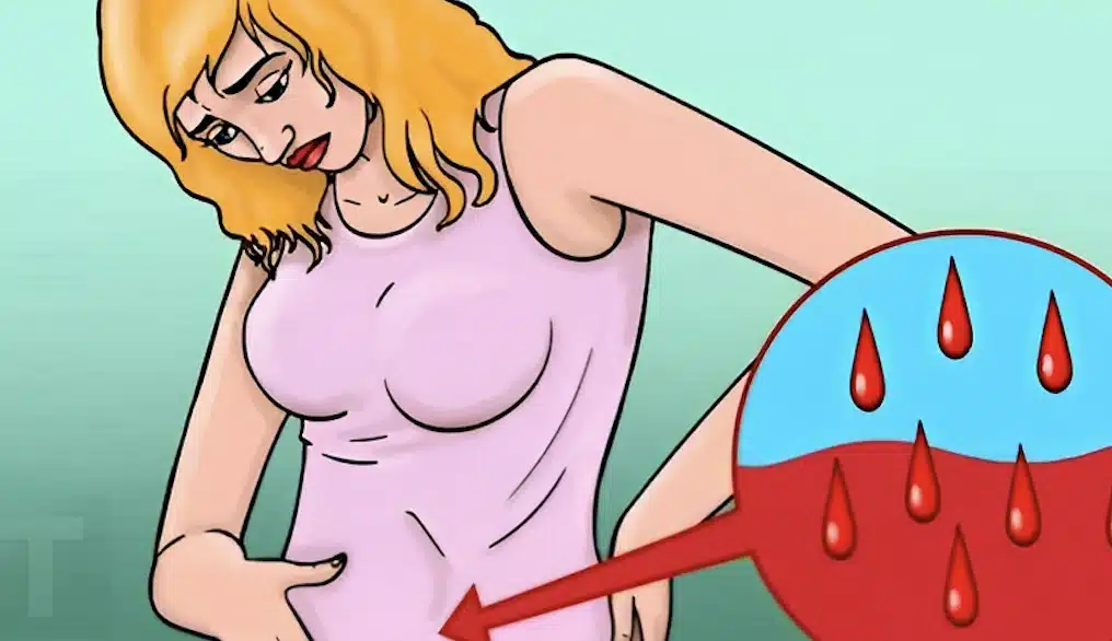 Συμπτώματα καρκίνου των ωοθηκών