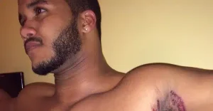 Εκεί που έκανε μπάνιο, ένιωσε κάτι να τον καίει κάτω από τη μασχάλη