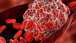 8 τροφές για την πρόληψη της ανεπιθύμητης πήξης