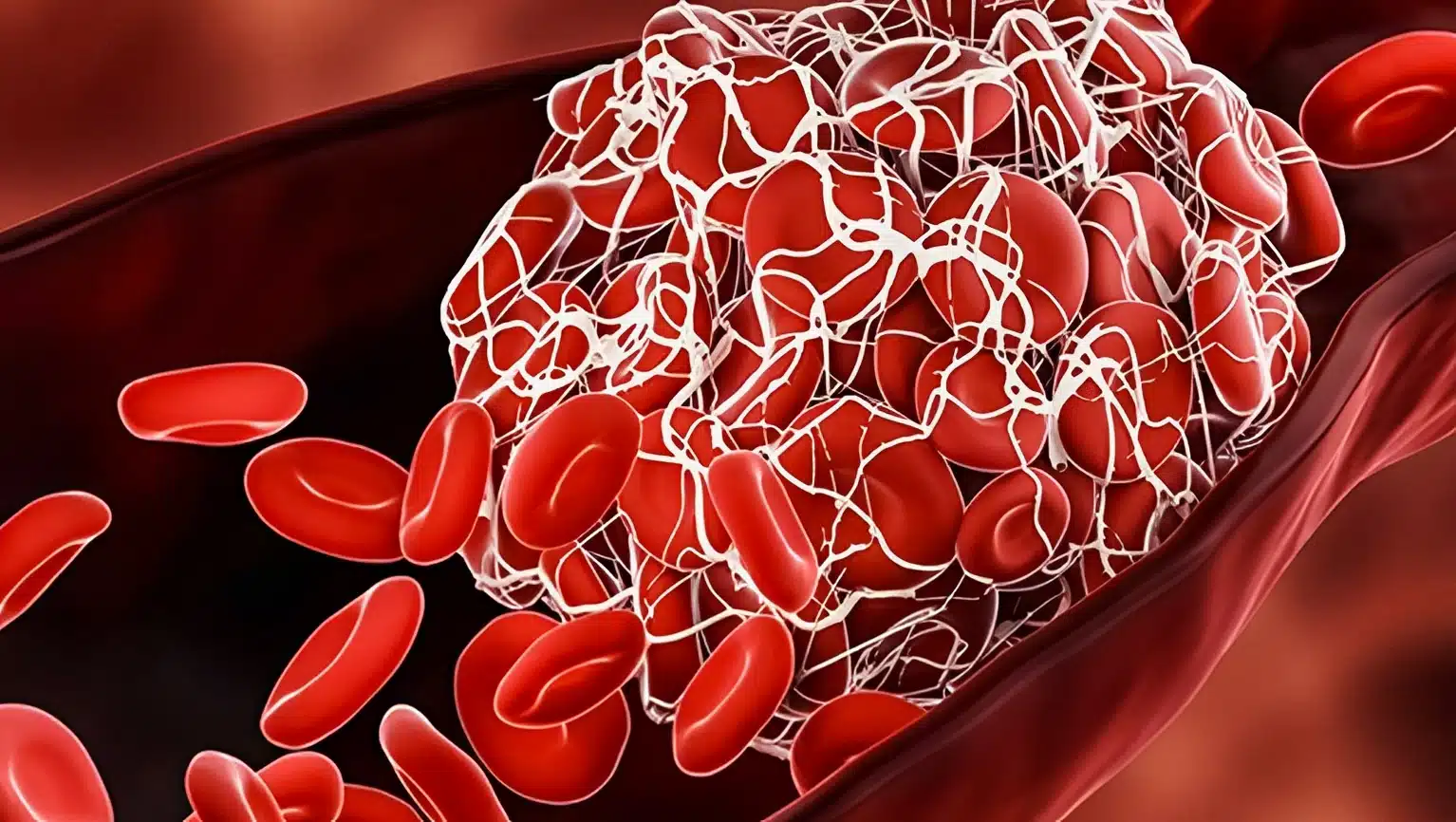 8 τροφές για την πρόληψη της ανεπιθύμητης πήξης