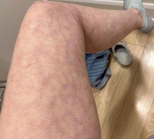 Αυτές είναι οι συνέπειες να κοιμάσαι με..