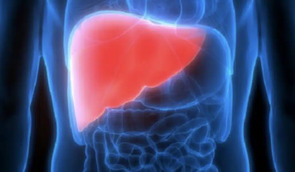 ΠΡΟΣΟΧΗ: Κινδυνεύει το συκώτι σας; 12 πρώιμα σημάδια κίρρωσης του ήπατος που δεν πρέπει να αγνοήσετε