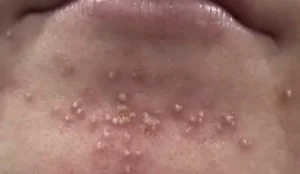 Αυτές είναι οι συνέπειες του να κοιμάσαι με…