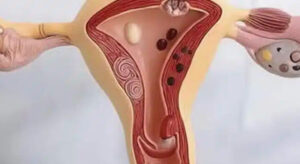 Έτσι αντιδρά το σώμα όταν…