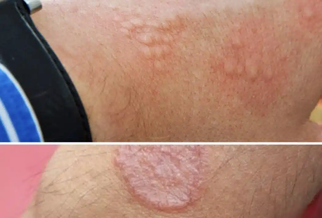 Αυτά είναι τα σημάδια ότι είναι...