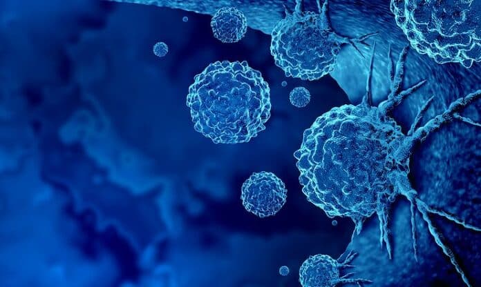 Φαίνονται «αθώα», αλλά προειδοποιοúν για καρκiνο: 6 úπουλα σημάδια που εμφανίζουν σχεδόν όλοι οι καρκινοπαθεiς