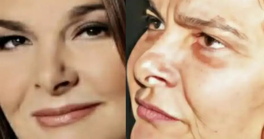 Αγνώριστη σήμερα στα 65 η πασίγνωστη τραγουδίστρια μεγάλων επιτυχιών