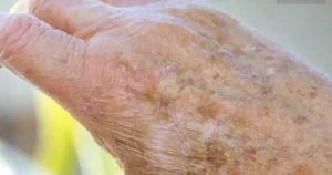 Αδιανόητο, γνωρίζατε ότι αν εμφανιστούν κηλίδες στα χέρια σας, είναι ξεκάθαρο σημάδι ότι…