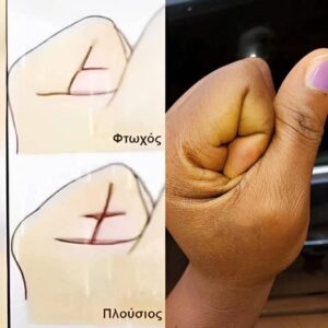 Το μυστικό αν θα γίνουμε φτωχοί ή πλούσιοι κρύβεται στην παλάμη του χεριού μας