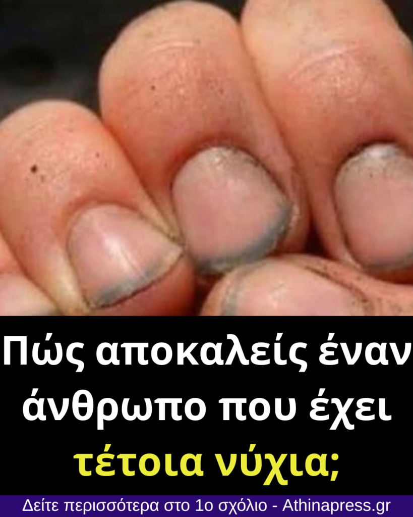 Πώς αποκαλείς έναν άνθρωπο που έχει τέτοια νύχια;