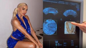 Η Ιωάννα Τούνη το τερμάτισε: Πήρε τους φίλους της στα social ακόμη και στην γυναικολόγο για να αποκαλύψει ότι έχει βάλει σπιράλ