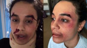 «Ποιος σου το έκανε αυτό;»: Ουρλιαχτά και κλάματα για την ηθοποιό Πηνελόπη Πλάκα