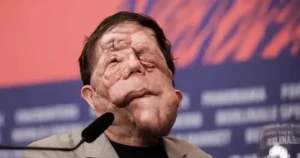 Xαμoς στα Όσκαρ: Πασίγνωστος ηθοποιός εμφανίστηκε με Auτo το πρόσωπο και… πάγωσαv όλοι – Η σπάνια Appώστια που τον «xτuπnσε»