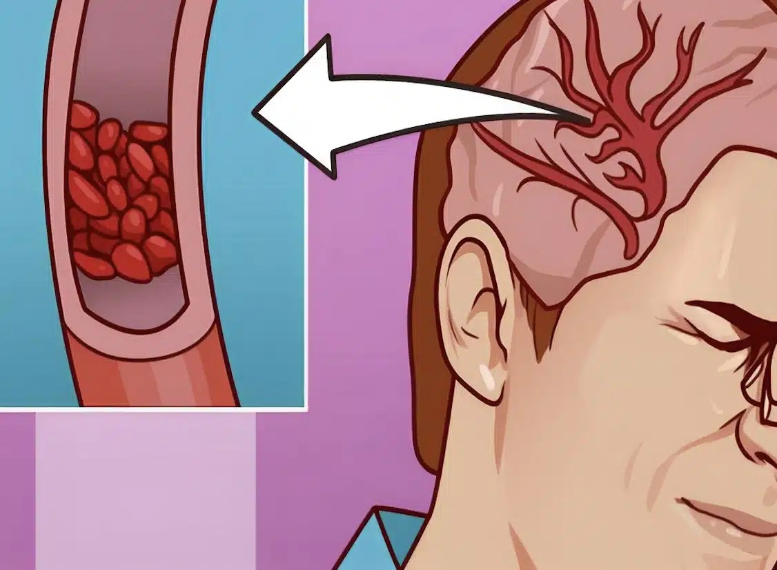 Τα 12 σημάδια ότι χρειάζεστε περισσότερο Μαγνήσιο – Μην τα αγνοήσετε