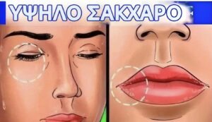 12 σημάδια ότι το σάκχαρό σας είναι πολύ υψηλό