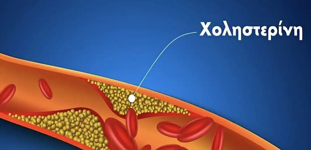 Έκτακτο τώρα – Χοληστερίνη: 2 φυσικές τροφές που τη μειώνουν αποτελεσματικά – Δρουν σαν τις στατίνες