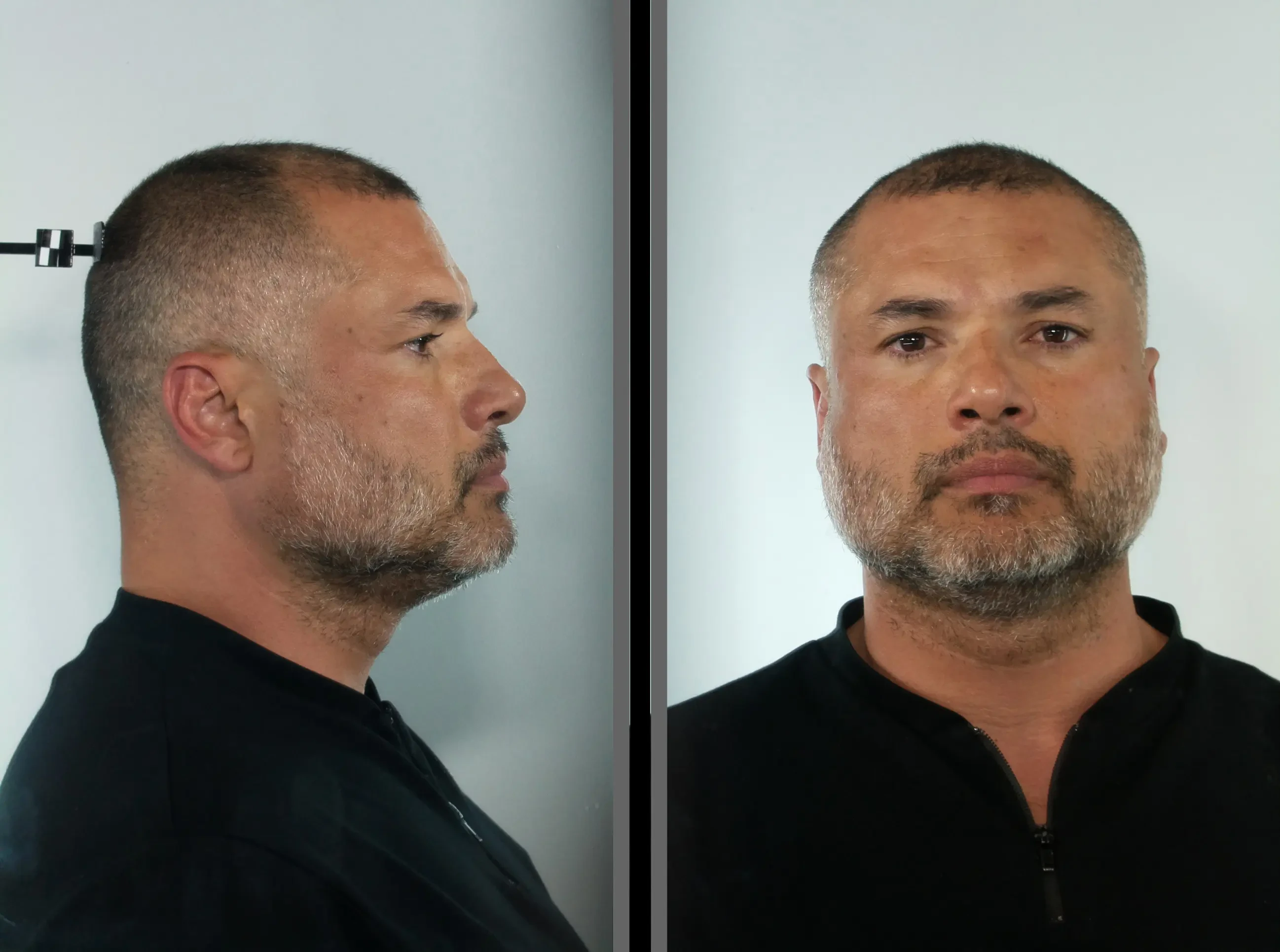 31032026 3.vilanakis markos 1