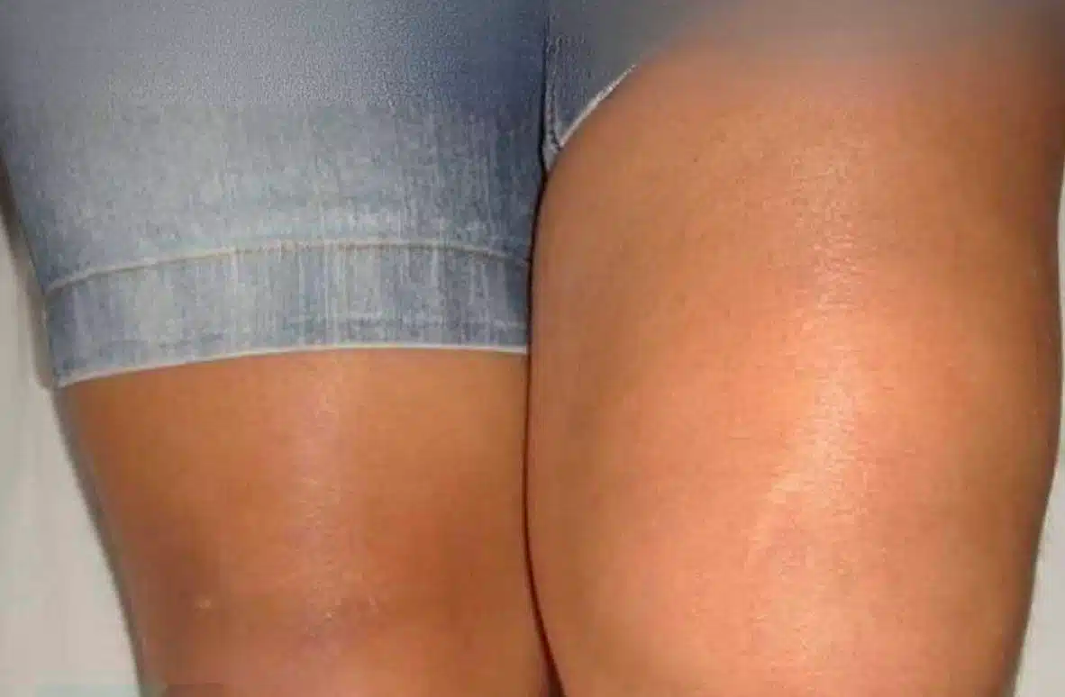 Αν δείτε το ένα πόδι πρησμένο τότε είναι σημάδι ότι…