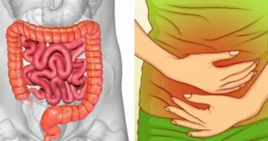 Αέρια στο έντερο: Τι δείχνουν για την υγεία μας – Ποιες οι αιτίες και πως να αντιμετωπίσουμε το πρόβλημα