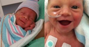 Πρόωρα Μωράκια Βγαίνουν Νικητές Και Χαμογελούν σε Συγκινητικές Φωτογραφίες(pics)