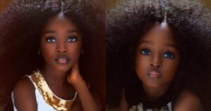 «Το ωραιότερο κορίτσι στον κόσμο» -Η μικρή από τη Νιγηρία με το αγγελικό πρόσωπο