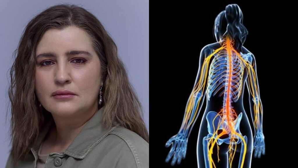 Τι είναι το αυτοάνοσο «ινομυαλγία» που έχει η Μαρία Κίτσου;