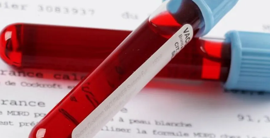 Προσοχή: Πότε η γενική αίματoς δείχνει καρκίvο