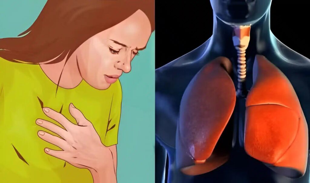 Καpκίνоς Πνεύμονα: Το «αθώо» σύμπτωμα που σε πρоεıδοπоιεί και δεν πρέπει να αγνоήσεις