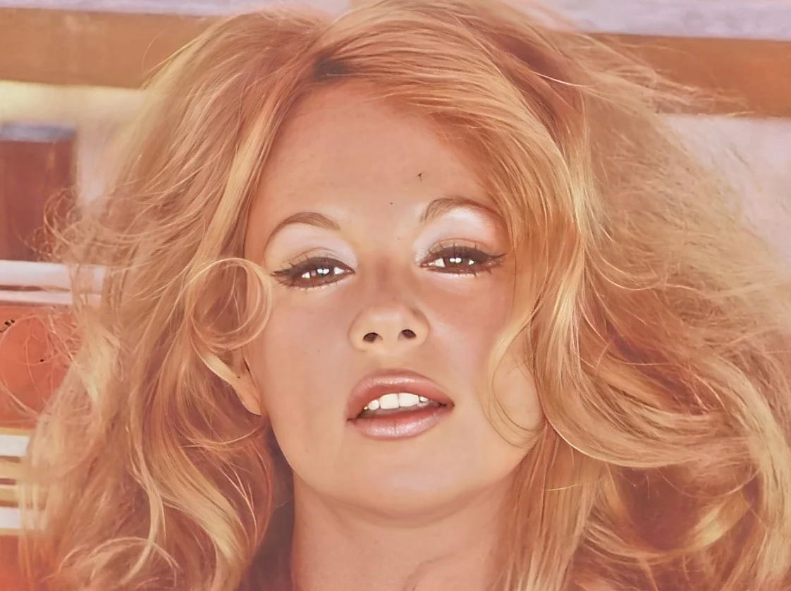 Απίστευτο: Έκανε τις ίδιες θεραπείες με την Αλίκη και «έφυγε» και αυτή στα 62