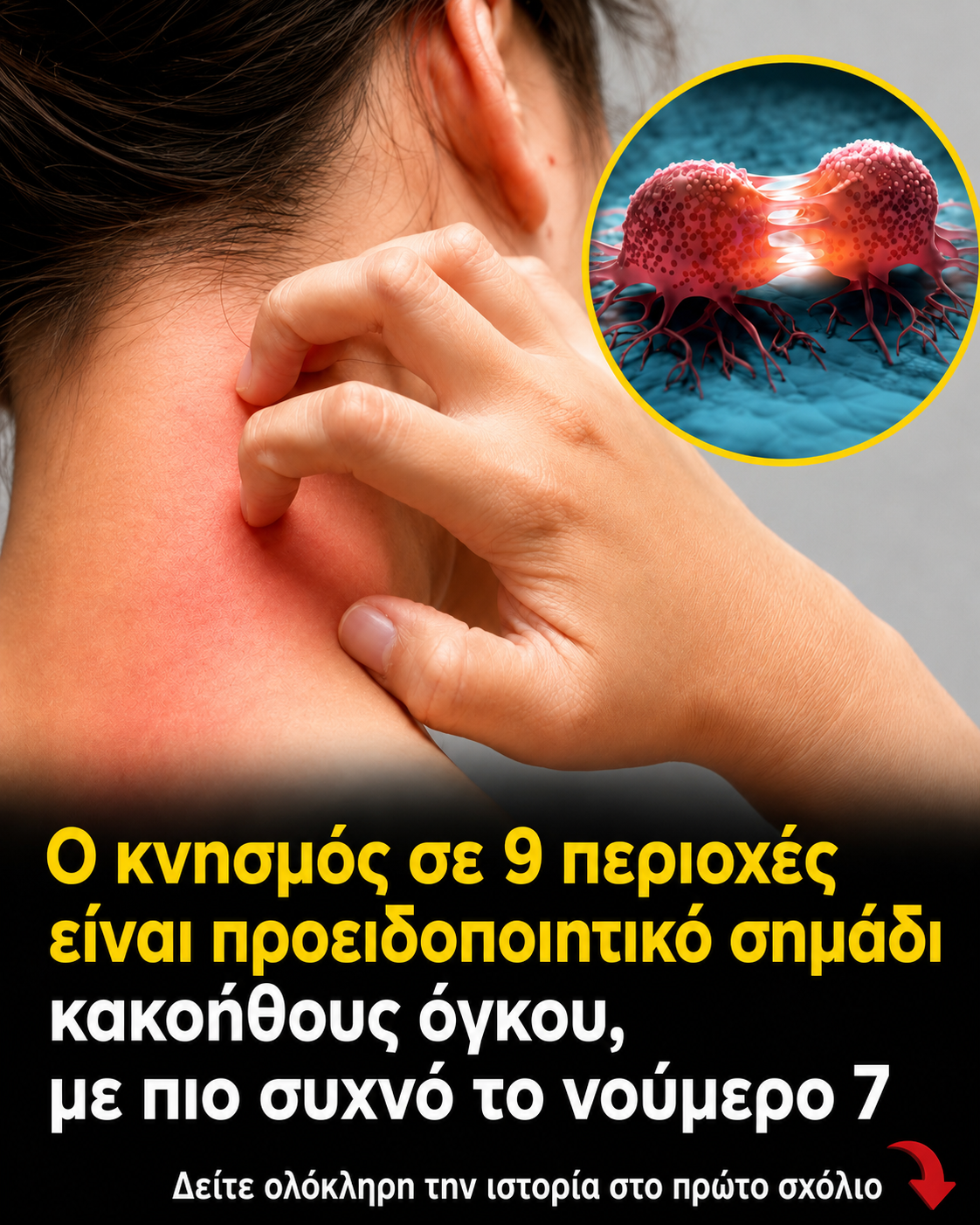 15+ Πρώιμα Προειδοποιητικά Σημάδια Καρκίνου που Δεν Πρέπει Ποτέ να Αγνοήσετε