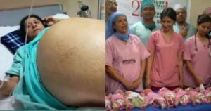 Ψευδείς ισχυρισμοί σχετικά με πολύδυμες γεννήσεις