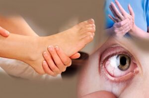 Σκλήρυνση κατά πλάκας (ΣΚΠ): Αuτά είναι τα Πρώιμα συμπτώματα
