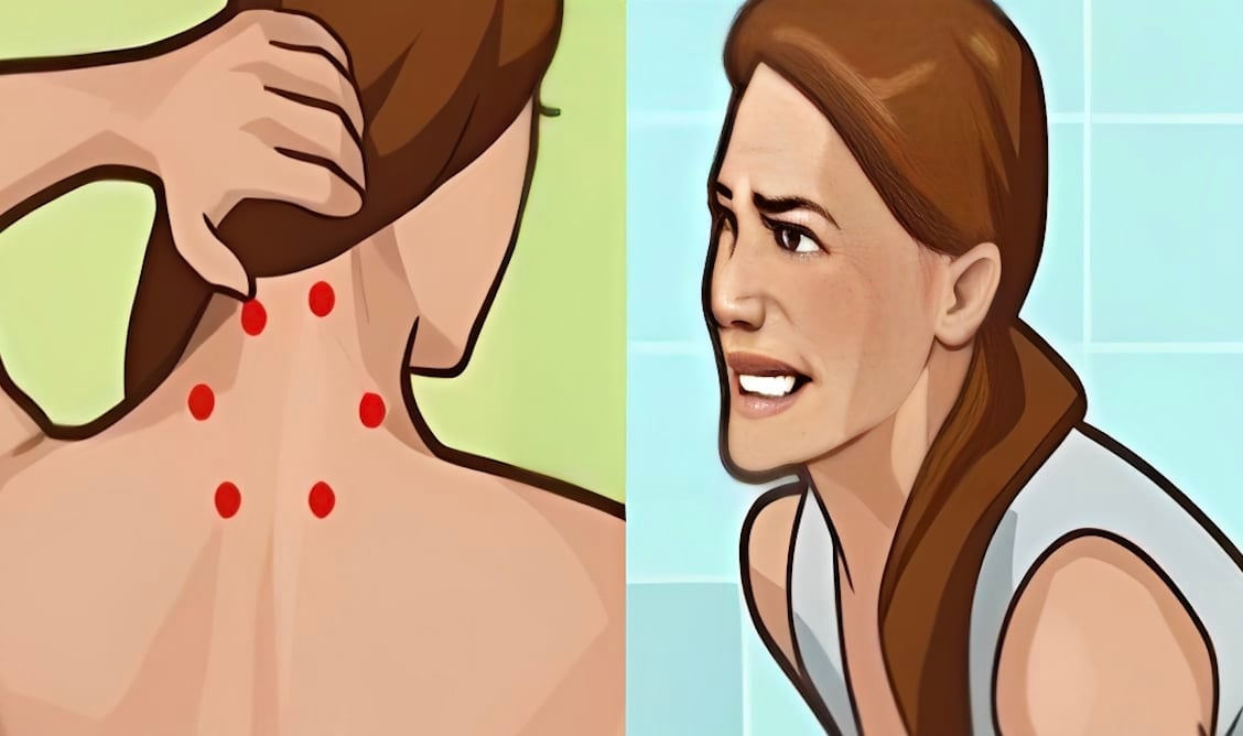 Ινομυαλγία: Η ύπουλη πάθηση που προκαλεί πόνο παντού – Πού οφείλεται και ποια είναι τα σημάδια