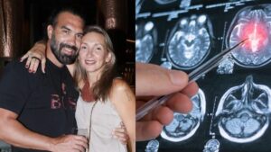 Τι είναι η ρήξη ανευρύσματος που υπέστη ο σύζυγος της Φανής Χαλκιά; Τα συμπτώματα που δεν πρέπει ποτέ να αγνοήσετε