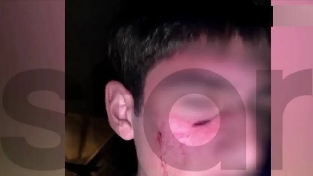 Άγριο bullying στα Τρίκαλα: 16χρονος κοπάναγε το κεφάλι συνομήλικού του σε αυτοκίνητο επειδή δεν του άρεσαν τα ρούχα του – «Πάμε πιο πέρα που δεν έχει κάμερες, θα σε σκοτώσω!»