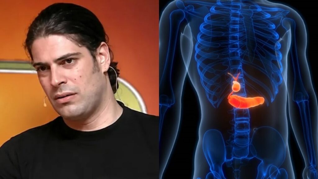 Θάνατος Καριέρε: Οι 7 ενδείξεις του καρκίνου στο πάγκρεας – Η ασθένεια που δεν δίνει σημάδια μέχρι να είναι αργά