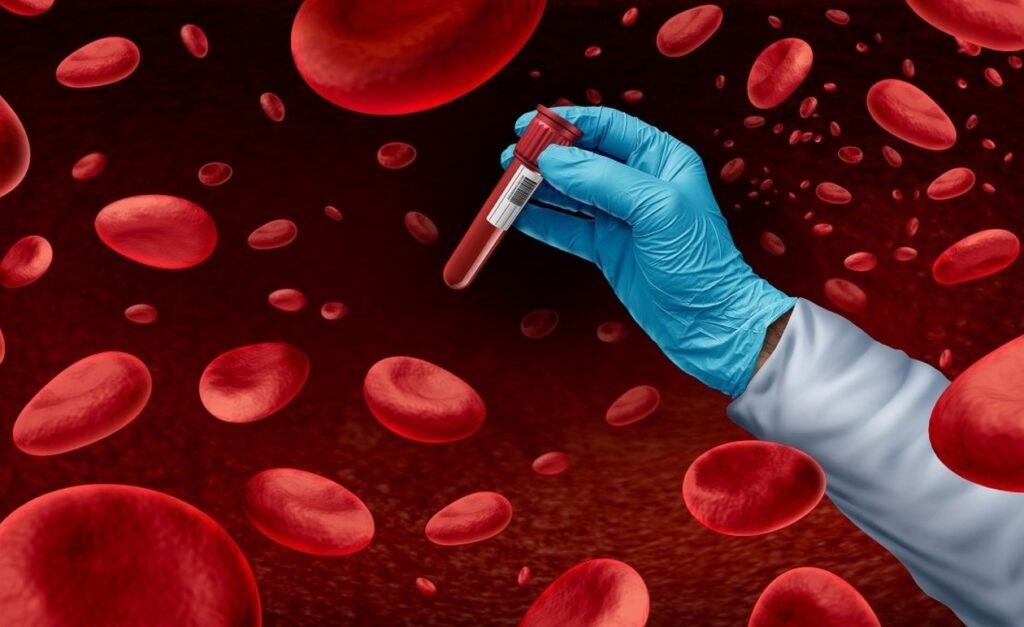 ΠΡΟΣΟΧΗ: Ποιες τιμές στις εξετάσεις αίματος μπορεί να υποδηλώνουν καρκίνο στο αίμα