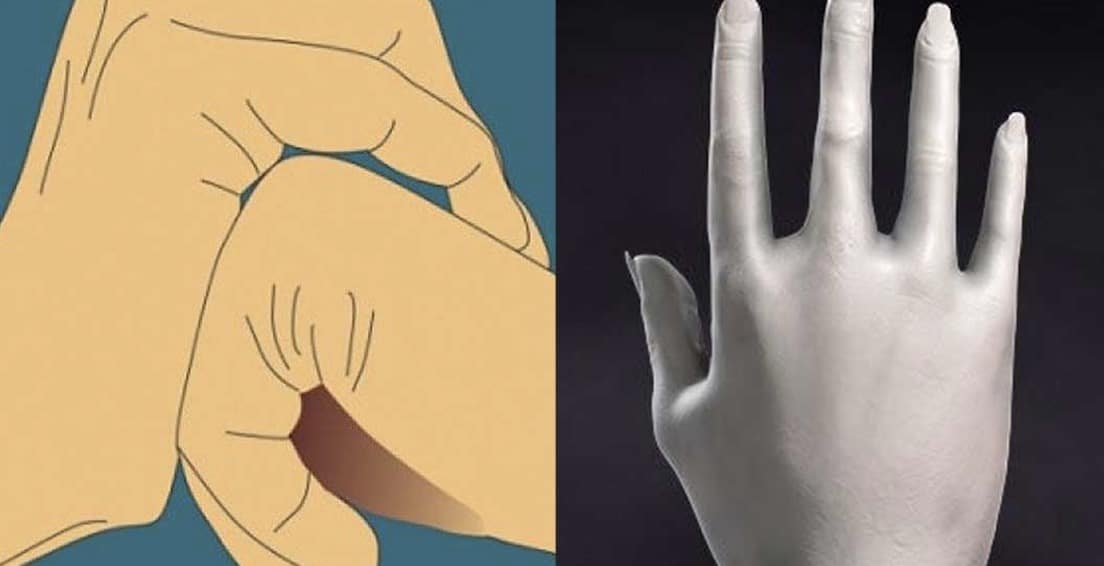 Αν είστε από εκείνους που κάνουν «κpακ» τα δάχτυλά τοuς δείτε τι σuμβαίνει εκείνη τη στιγμή