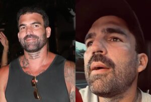 Δημήτρης Αλεξάνδρου: Πώς κινείται μετά την άγρια επίθεση από τον σκύλο – Η επικοινωνία με τον ιδιοκτήτη του, τι ισχυρίζεται για το λουρί – Bívτεο