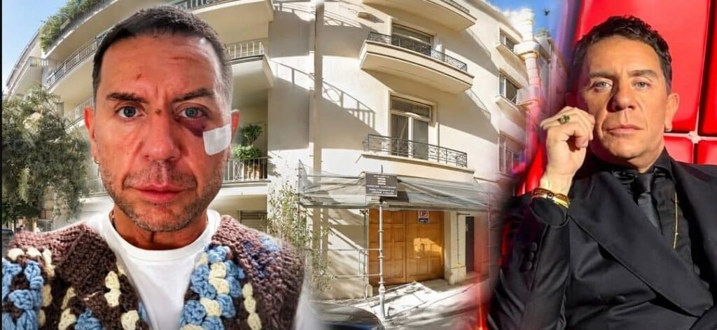 “Σβήνω σώστε με” Τι είναι η θεραπεία πλασμαφαίρεσης που πήγε να κάνει στο Κολωνάκι ο Γιώργος Μαζωνάκης