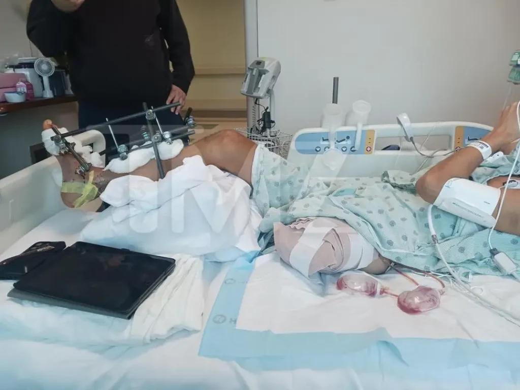 Ο Σταύρος Φλώρος ζητάει πάνω από 100 εκατ. δολάρια μετά τον ακρωτηριασμό του ποδιού του